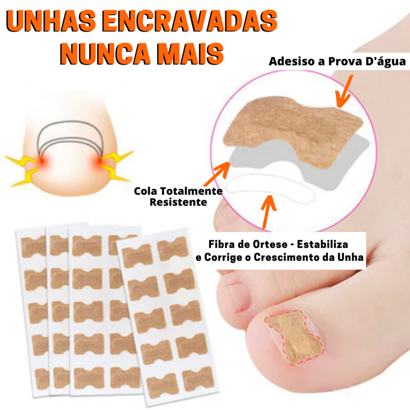 Adesivo Para Unha Encravada - Painless PRO